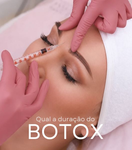 Post sobre duração do botox